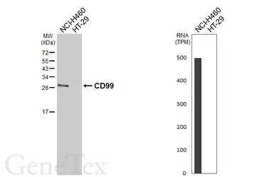 Anti-CD99 antibody [GT407] used in Western Blot (WB). GTX648368