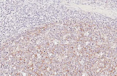Anti-VCAM1 / CD106 antibody [HL6285] used in IHC (Paraffin sections) (IHC-P). GTX648387