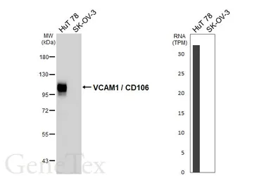 Anti-VCAM1 / CD106 antibody [HL6285] used in Western Blot (WB). GTX648387