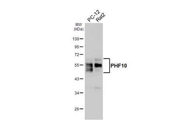 Anti-PHF10 antibody [HL6286] used in Western Blot (WB). GTX648388
