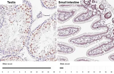 Anti-PHF10 antibody [HL6286] used in IHC (Paraffin sections) (IHC-P). GTX648388