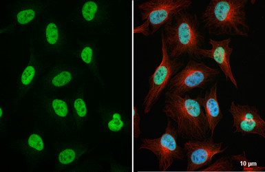 Anti-PHF10 antibody [HL6286] used in Immunocytochemistry/ Immunofluorescence (ICC/IF). GTX648388