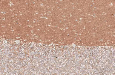 Anti-CD81 antibody [HL6288] used in IHC (Paraffin sections) (IHC-P). GTX648390
