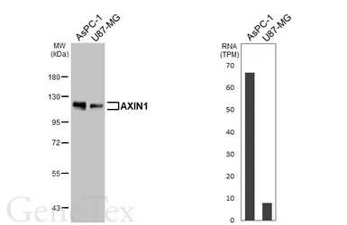 Anti-AXIN1 antibody [HL6295] used in Western Blot (WB). GTX648397