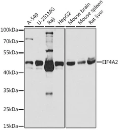 Anti-EIF4A2 antibody used in Western Blot (WB). GTX64840