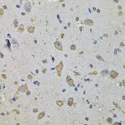 Anti-EIF4A2 antibody used in IHC (Paraffin sections) (IHC-P). GTX64840