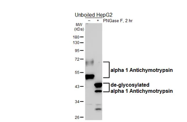 Anti-alpha 1 Antichymotrypsin antibody [HL6303] used in Western Blot (WB). GTX648405