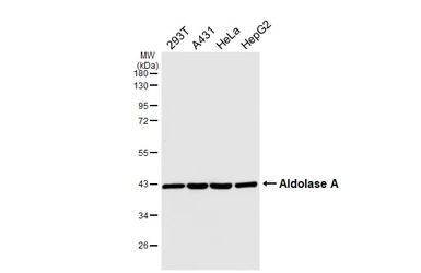 Anti-Aldolase A antibody [HL6304] used in Western Blot (WB). GTX648406