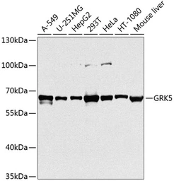 Anti-GRK5 antibody used in Western Blot (WB). GTX64841