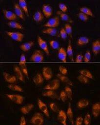 Anti-GRK5 antibody used in Immunocytochemistry/ Immunofluorescence (ICC/IF). GTX64841