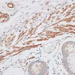Anti-GRK5 antibody used in IHC (Paraffin sections) (IHC-P). GTX64841