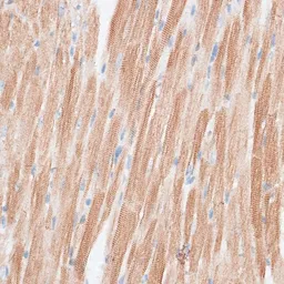 Anti-GRK5 antibody used in IHC (Paraffin sections) (IHC-P). GTX64841