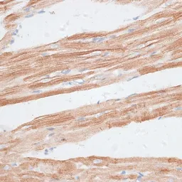 Anti-GRK5 antibody used in IHC (Paraffin sections) (IHC-P). GTX64841