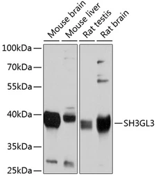 Anti-SH3GL3 antibody used in Western Blot (WB). GTX64842