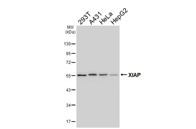 Anti-XIAP antibody [HL6316] used in Western Blot (WB). GTX648426