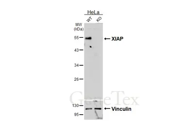 Anti-XIAP antibody [HL6316] used in Western Blot (WB). GTX648426