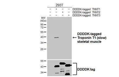 Anti-Troponin T1 (slow) skeletal muscle antibody [HL6319] used in Western Blot (WB). GTX648429