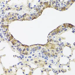 Anti-TOMM34 antibody used in IHC (Paraffin sections) (IHC-P). GTX64843