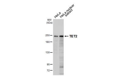 Anti-TET2 antibody [HL6324] used in Western Blot (WB). GTX648434