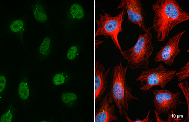 Anti-TET2 antibody [HL6324] used in Immunocytochemistry/ Immunofluorescence (ICC/IF). GTX648434