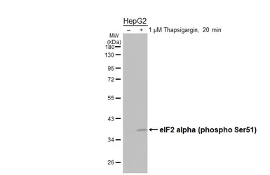Anti-eIF2 alpha (phospho Ser51) antibody [HL6327] used in Western Blot (WB). GTX648437