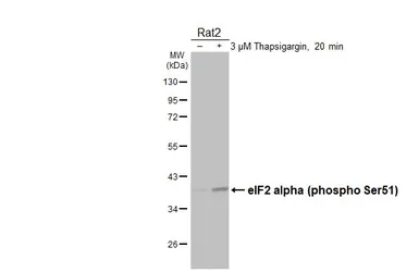 Anti-eIF2 alpha (phospho Ser51) antibody [HL6327] used in Western Blot (WB). GTX648437