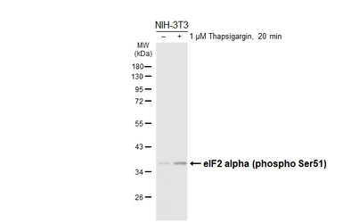 Anti-eIF2 alpha (phospho Ser51) antibody [HL6327] used in Western Blot (WB). GTX648437