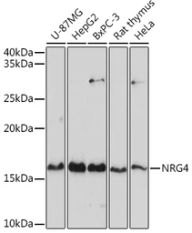 Anti-NRG4 antibody used in Western Blot (WB). GTX64845