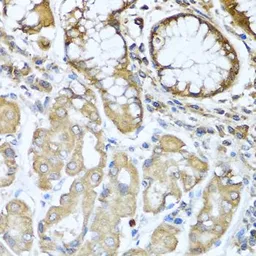 Anti-NRG4 antibody used in IHC (Paraffin sections) (IHC-P). GTX64845