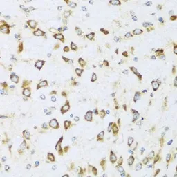 Anti-NRG4 antibody used in IHC (Paraffin sections) (IHC-P). GTX64845