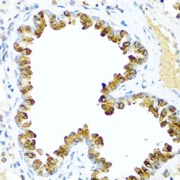 Anti-NRG4 antibody used in IHC (Paraffin sections) (IHC-P). GTX64845