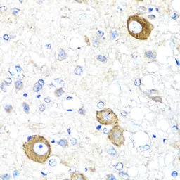Anti-NRG4 antibody used in IHC (Paraffin sections) (IHC-P). GTX64845