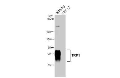 Anti-TRP1 antibody [HL6342] used in Western Blot (WB). GTX648452