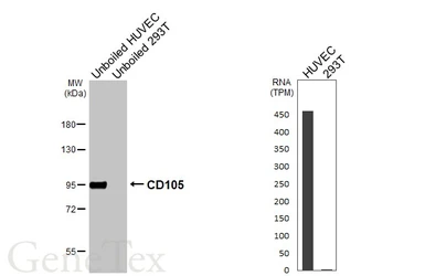 Anti-CD105 antibody [HL6345] used in Western Blot (WB). GTX648455