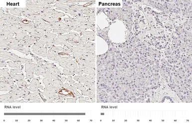 Anti-CD105 antibody [HL6345] used in IHC (Paraffin sections) (IHC-P). GTX648455