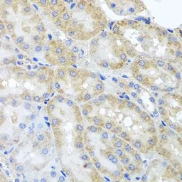 Anti-PEX3 antibody used in IHC (Paraffin sections) (IHC-P). GTX64847
