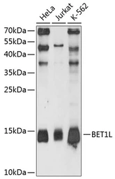 Anti-BET1L antibody used in Western Blot (WB). GTX64850