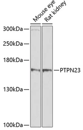 Anti-PTPN23 antibody used in Western Blot (WB). GTX64851