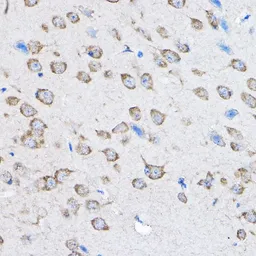 Anti-PTPN23 antibody used in IHC (Paraffin sections) (IHC-P). GTX64851