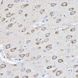 Anti-PTPN23 antibody used in IHC (Paraffin sections) (IHC-P). GTX64851