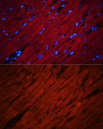 Anti-SOS1 antibody used in IHC (Paraffin sections) (IHC-P). GTX64852