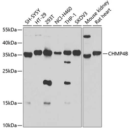 Anti-CHMP4B antibody used in Western Blot (WB). GTX64853