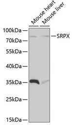 Anti-SRPX antibody used in Western Blot (WB). GTX64860