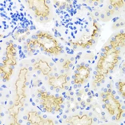 Anti-SRPX antibody used in IHC (Paraffin sections) (IHC-P). GTX64860