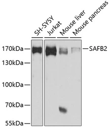 Anti-SAFB2 antibody used in Western Blot (WB). GTX64864