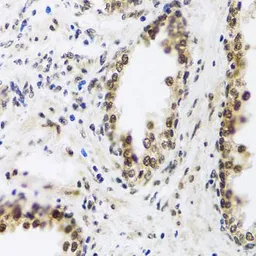 Anti-SAFB2 antibody used in IHC (Paraffin sections) (IHC-P). GTX64864