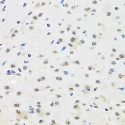 Anti-SAFB2 antibody used in IHC (Paraffin sections) (IHC-P). GTX64864
