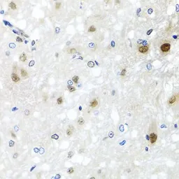 Anti-SAFB2 antibody used in IHC (Paraffin sections) (IHC-P). GTX64864