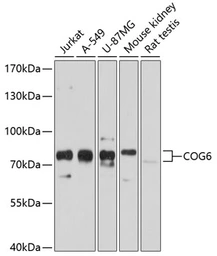 Anti-COG6 antibody used in Western Blot (WB). GTX64872
