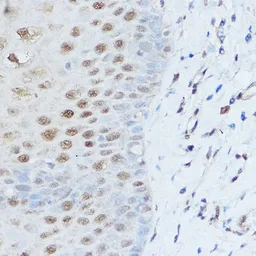 Anti-SMARCD2 antibody used in IHC (Paraffin sections) (IHC-P). GTX64874